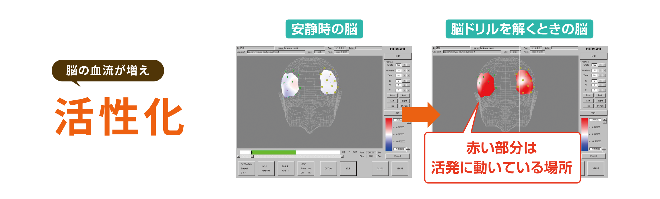 脳の血流が増え 活性化