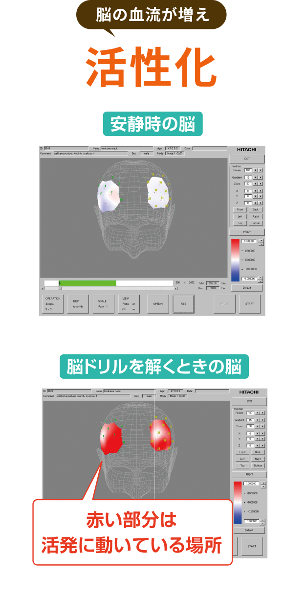 脳の血流が増え 活性化